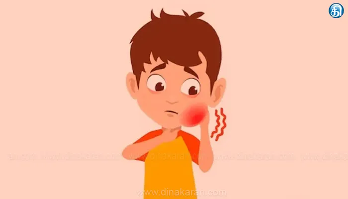 தமிழகத்தில் பொன்னுக்கு வீங்கி அதிகரிப்பு: ஆய்வில் தகவல், சிகிச்சை முறைகள் அறிவிப்பு