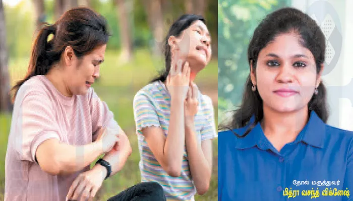 கோடை கால சரும நோய்கள்…