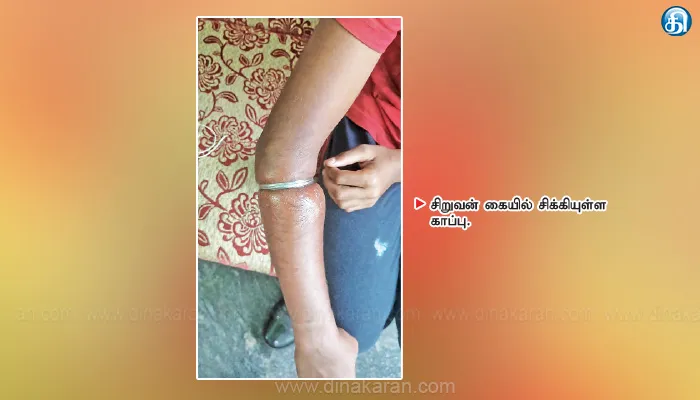 குலசேகரம் அருகே சிறுவன் கையில் சிக்கிய காப்பு