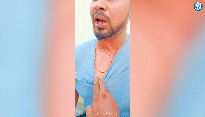 குறுக்கு தெருவில் பைக்குக்கு வழிவிடும் பிரச்னை; வாலிபரை தாக்கி சட்டையை கிழித்த இன்ஸ்பெக்டரின் செயலால் அதிர்ச்சி: காயத்துடன் ஆஸ்பத்திரியில் அட்மிட்